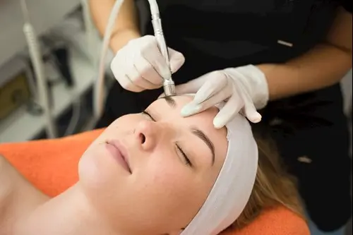 Microdermabrasion Diamant